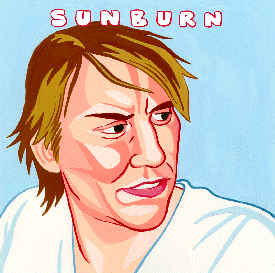 Sunburn